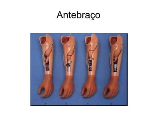 Antebraço
 