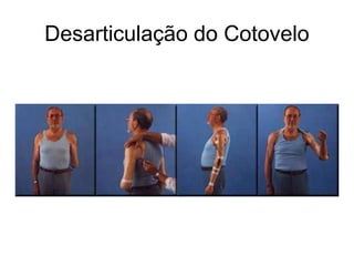 Desarticulação do Cotovelo
 