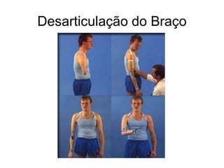 Desarticulação do Braço
 