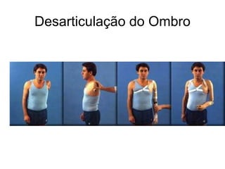 Desarticulação do Ombro
 