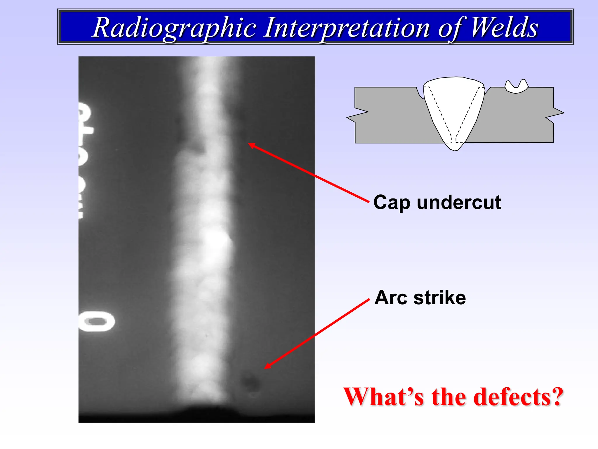 Undercut Radiograph radiografía e interpretación de las soldaduras | PDF