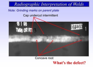 Undercut Radiograph radiografía e interpretación de las soldaduras | PDF