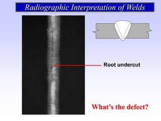 Undercut Radiograph radiografía e interpretación de las soldaduras | PDF