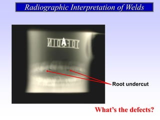 Undercut Radiograph radiografía e interpretación de las soldaduras | PDF