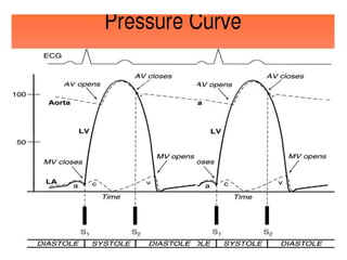 Rhc Waveforms Right heart catheterization | PPSX