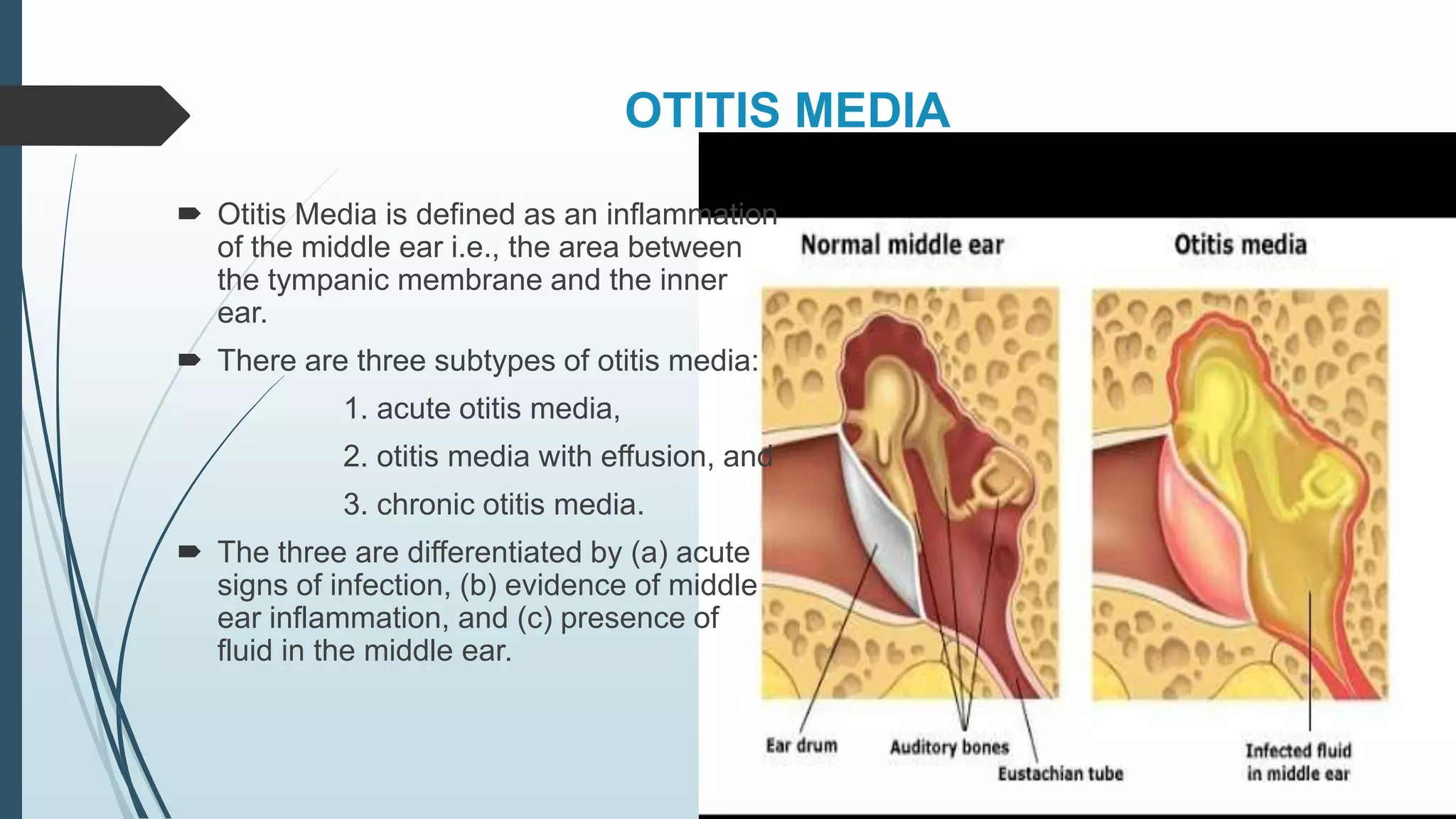 Respiratory tract infections (Upper and Lower) | PPTX