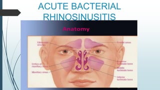 ACUTE BACTERIAL
RHINOSINUSITIS
 