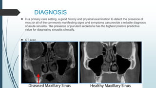 DIAGNOSIS
 In a primary care setting, a good history and physical examination to detect the presence of
most or all of the commonly manifesting signs and symptoms can provide a reliable diagnosis
of acute sinusitis. The presence of purulent secretions has the highest positive predictive
value for diagnosing sinusitis clinically.
 CT scan
 