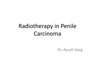Radiotherapy in Penile
Carcinoma
Dr. Ayush Garg
 