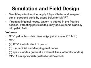 Simulation and Field Design
• Simulate patient supine; apply foley catheter and suspend
penis; surround penis by tissue bolus for MV RT.
• If treating inguinal nodes, patient is treated in the frog-leg
position. If treating pelvic nodes, may secure penis cranially
into pelvic field.
Volumes
• GTV: palpable/visible disease (physical exam, CT, MRI)
• CTV:
• (a) GTV + whole shaft of penis
• (b) ±superficial and deep inguinal nodes
• (c) ±pelvic nodes (internal + external iliacs, obturator nodes)
• PTV: 1 cm appropriate(Institutional Protocol)
 