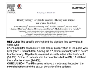 RESULTS: The specific survival and the disease-free survival at 5
years was
87.6% and 84% respectively. The rate of preservation of the penis was
66% (n531). Sexual data: Among the 17 patients sexually active before
brachytherapy, 10 patients remained sexually active after treatment
(58.8%). Of the 18 patients who had erections before PB, 17 still had
them after treatment (94.4%).
CONCLUSION: The PB seems to have a moderated impact on the
sexual functions and the sexual behavior of the patients.
 