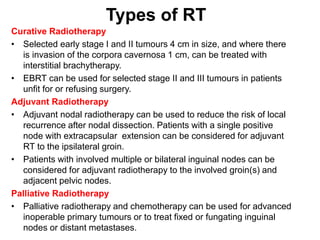 Types of RT
Curative Radiotherapy
• Selected early stage I and II tumours 4 cm in size, and where there
is invasion of the corpora cavernosa 1 cm, can be treated with
interstitial brachytherapy.
• EBRT can be used for selected stage II and III tumours in patients
unfit for or refusing surgery.
Adjuvant Radiotherapy
• Adjuvant nodal radiotherapy can be used to reduce the risk of local
recurrence after nodal dissection. Patients with a single positive
node with extracapsular extension can be considered for adjuvant
RT to the ipsilateral groin.
• Patients with involved multiple or bilateral inguinal nodes can be
considered for adjuvant radiotherapy to the involved groin(s) and
adjacent pelvic nodes.
Palliative Radiotherapy
• Palliative radiotherapy and chemotherapy can be used for advanced
inoperable primary tumours or to treat fixed or fungating inguinal
nodes or distant metastases.
 