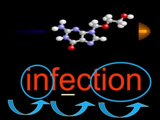 infection
 