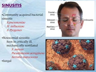 SINUSITIS
•Community acquired bacterial
sinusitis
S.pneumoniae
H. influenzae
S. Pyogenes
•Nosocomial sinusitis
Seen in critically ill,
mechanically ventilated
S. aureus
Pseudomonas aeruginosa
Serratia marcescens
•fungal
 