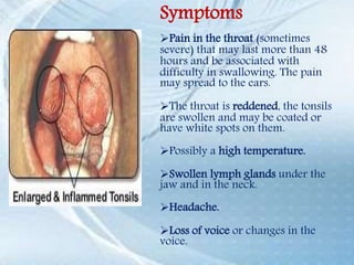 Symptoms
Pain in the throat (sometimes
severe) that may last more than 48
hours and be associated with
difficulty in swallowing. The pain
may spread to the ears.
The throat is reddened, the tonsils
are swollen and may be coated or
have white spots on them.
Possibly a high temperature.
Swollen lymph glands under the
jaw and in the neck.
Headache.
Loss of voice or changes in the
voice.
 