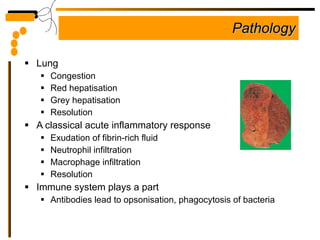 Pathology Lung Congestion  Red hepatisation Grey hepatisation Resolution A classical acute inflammatory response Exudation of fibrin-rich fluid Neutrophil infiltration Macrophage infiltration Resolution Immune system plays a part  Antibodies lead to opsonisation, phagocytosis of bacteria 
