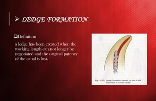 Ledge Radiograph Endodontic mishaps during RCT | PDF