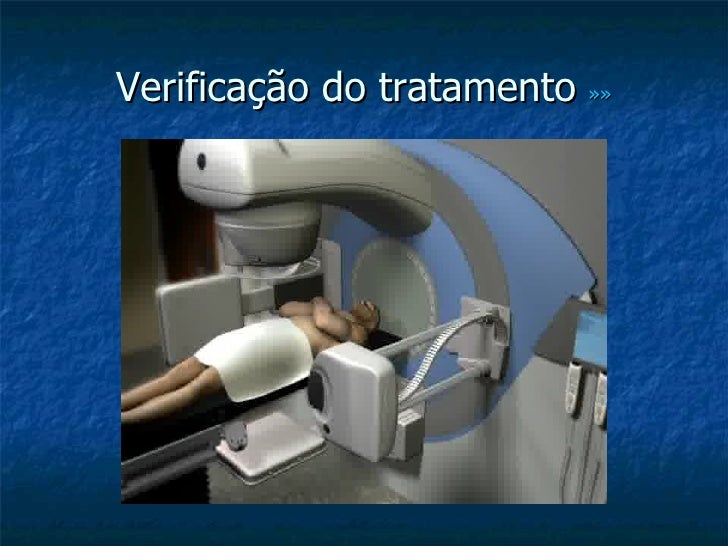 Radioterapia no Cancro da Mama