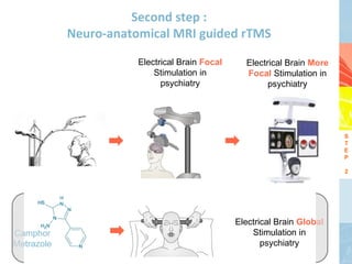 Second step :
            Neuro-anatomical MRI guided rTMS
                       Electrical Brain Focal     Electrical Brain More
                           Stimulation in         Focal Stimulation in
                             psychiatry                 psychiatry




                                                                          S
                                                                          T
                                                                          E
                                                                          P

                                                                          2




                                                Electrical Brain Global
Camphor                                             Stimulation in
Metrazole                                              psychiatry
 