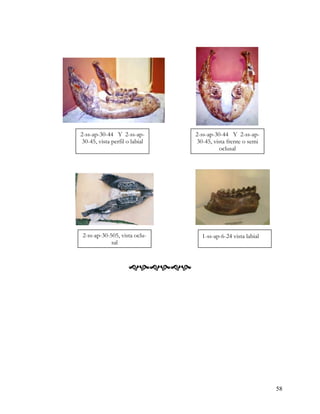 2-ss-ap-30-44 Y 2-ss-ap-        2-ss-ap-30-44 Y 2-ss-ap-
 30-45, vista perfil o labial   30-45, vista frente o semi
                                          oclusal




 2-ss-ap-30-505, vista oclu-      1-ss-ap-6-24 vista labial
             sal



                     




                                                              58
 