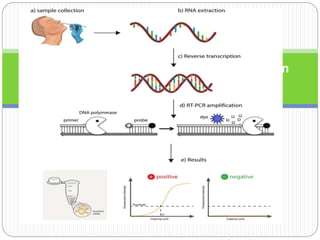 Reverse transcription polymerase chain
reaction (RT-PCR)
 