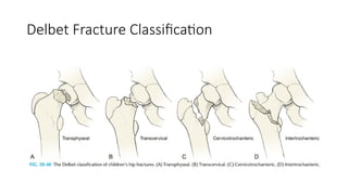 Rt Classification rt peds injury around HIP.pptx applied ana | PPTX