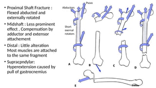 R Extensor Comp rt peds injury around HIP.pptx applied ana | PPTX