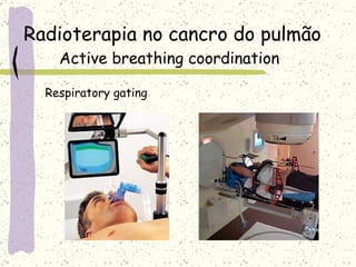 Radioterapia no cancro do pulmão Active breathing coordination Respiratory gating 
