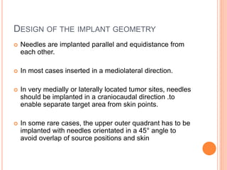 DESIGN OF THE IMPLANT GEOMETRY
 Needles are implanted parallel and equidistance from
each other.
 In most cases inserted in a mediolateral direction.
 In very medially or laterally located tumor sites, needles
should be implanted in a craniocaudal direction .to
enable separate target area from skin points.
 In some rare cases, the upper outer quadrant has to be
implanted with needles orientated in a 45° angle to
avoid overlap of source positions and skin
 