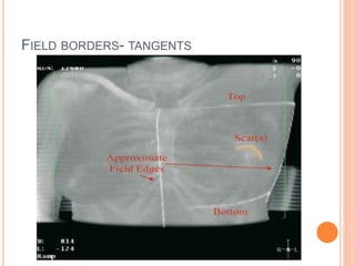 FIELD BORDERS- TANGENTS
 