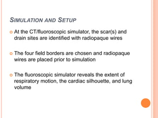SIMULATION AND SETUP
 At the CT/fluoroscopic simulator, the scar(s) and
drain sites are identified with radiopaque wires
 The four field borders are chosen and radiopaque
wires are placed prior to simulation
 The fluoroscopic simulator reveals the extent of
respiratory motion, the cardiac silhouette, and lung
volume
 