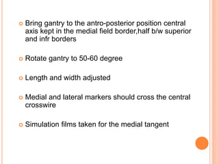  Bring gantry to the antro-posterior position central
axis kept in the medial field border,half b/w superior
and infr borders
 Rotate gantry to 50-60 degree
 Length and width adjusted
 Medial and lateral markers should cross the central
crosswire
 Simulation films taken for the medial tangent
 