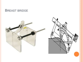BREAST BRIDGE
 