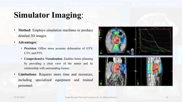 Cd R Radiotherapy Radiotherapy Treatment Planning Procedure.pptx | 3-D Graphics ...