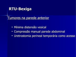 RTU-Bexiga Tumores na parede anterior   Mínima distensão vesical  Compressão manual parede abdominal  Uretrostomia perineal temporária como acesso 
