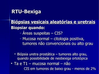 RTU-Bexiga Biópsias vesicais aleatórias e uretrais Biopsiar quando: Áreas suspeitas – CIS?  Mucosa normal – citologia positiva, tumores não convencionais ou alto grau Biópsia uretra prostática – tumores alto grau, quando possibilidade de neobexiga ortotópica  Ta e T1 – mucosa normal – não CIS em tumores de baixo grau - menos de 2% 
