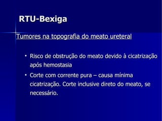 RTU-Bexiga Tumores na topografia do meato ureteral   Risco de obstrução do meato devido à cicatrização após hemostasia Corte com corrente pura – causa mínima cicatrização. Corte inclusive direto do meato, se necessário. 