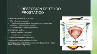 z
RESECCIÓN DE TEJIDO
PROSTÁTICO
 Independientemente de la tecnica
 Plan ordenado de resección
 “La técnica real final no es tan importante como la planificación
cuidadosa y la ejecución con precisión”
 Cirugía completa y siempre estar orientado
 Una vez inicie un área
 Terminar (sangrado y absorción)
 Finalizar si hay complicaciones
 Cortes al tirar el asa no empujando
 Lóbulo medio grande y obstructivo 1ero
 Cortes pequeños en la hendidura de cada lóbulo lateral y lóbulo
medio (suministro sanguíneo)
 