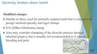 Severely broken down teeth
Modified clamps:
 Similar to those used for partially erupted tooth that is clamps with
prongs...