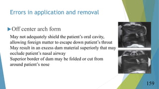 Errors in application and removal
Off center arch form
159
May not adequately shield the patient’s oral cavity,
allowing ...