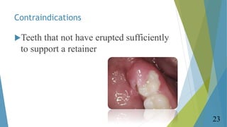 Contraindications
Teeth that not have erupted sufficiently
to support a retainer
23
 