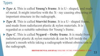 Types
 Type A. This is called Young’s frame. It is U– shaped, and made
of metal. It might interfere with the X– ray causi...