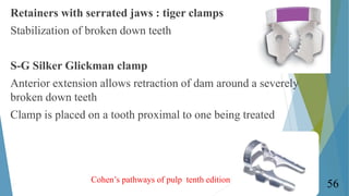 Retainers with serrated jaws : tiger clamps
Stabilization of broken down teeth
S-G Silker Glickman clamp
Anterior extensio...