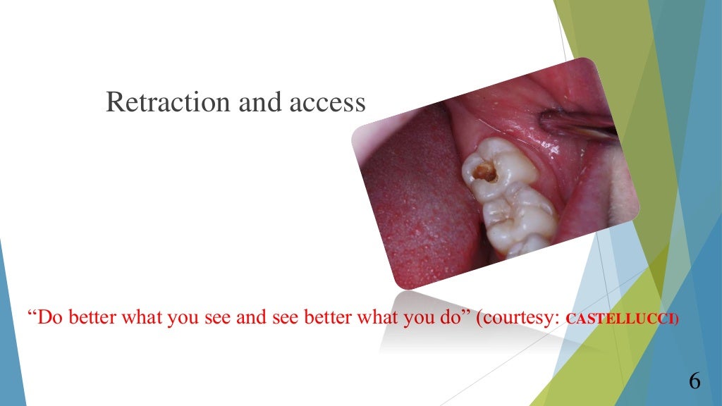 RUBBER DAM IN ENDODONTICS