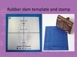 RECENT ALTERNATIVES TO RUBBER DAM
• KOOL DAM (PULPDENT CORPORATION)
It is a light cured material applied on
the gingiva or...