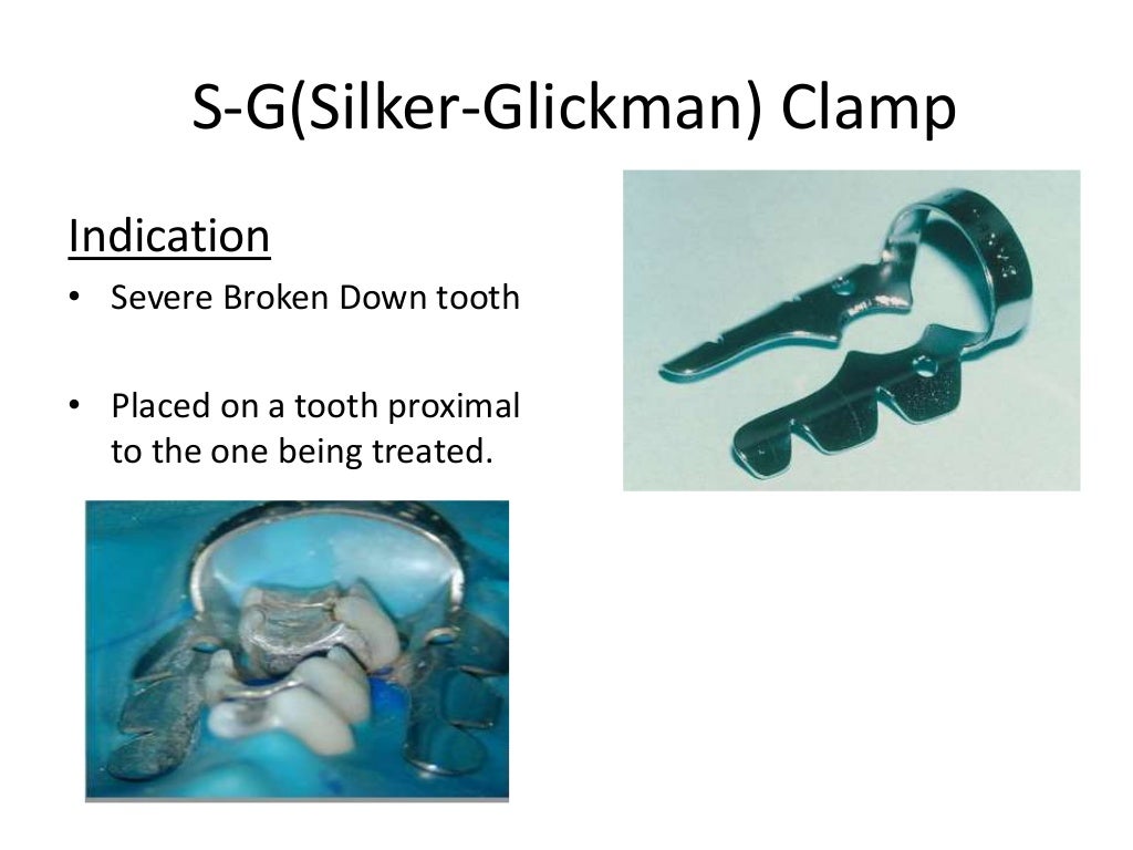 Rubber dam application