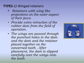 2).Wingless retainers

      Having no wings. The
      retainer is first placed on
      the tooth and the dam
      then...