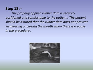Step 19 :-
   Check to see that the completed rubber dam
provides maximal access and visibility for the operative
procedur...