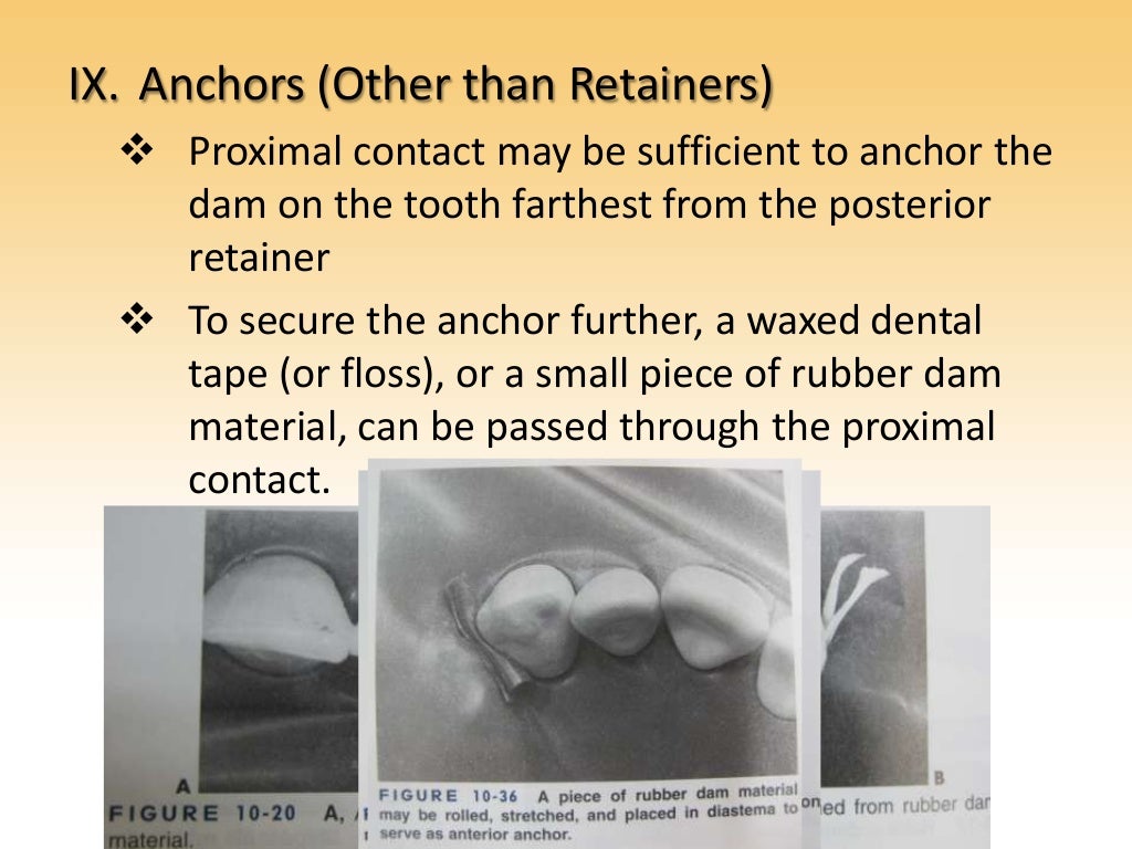 Rubber Dam Dentistry