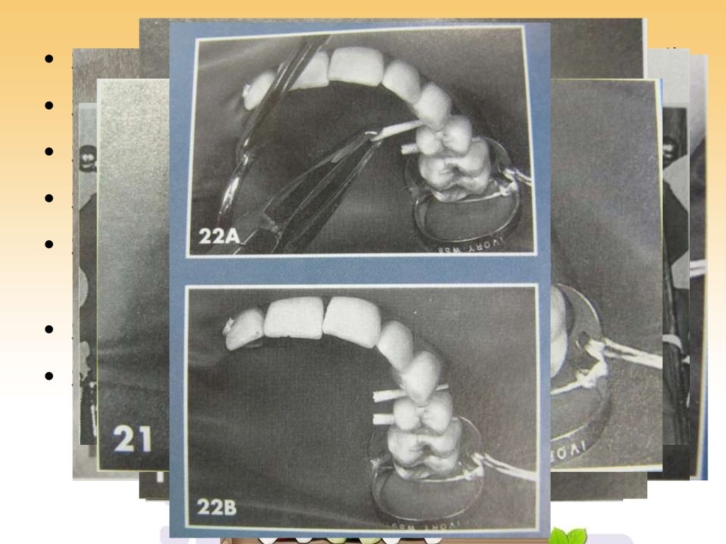 Rubber Dam Dentistry